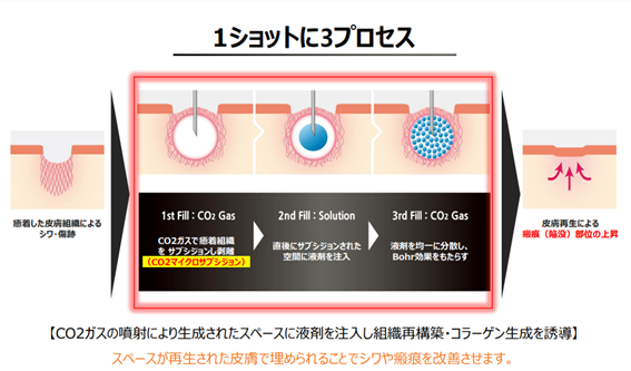 トライフィル基本原理
