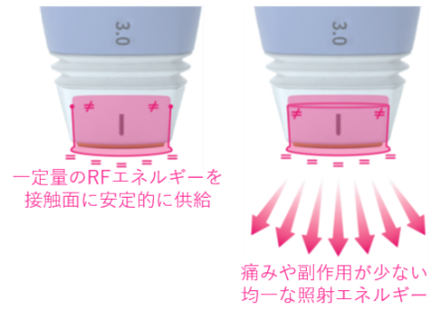 特許取得のチップ