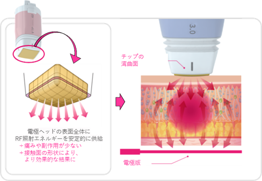 仕組み